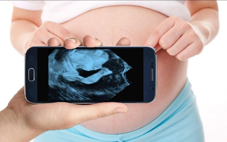 fazer ultrassom no seu celular